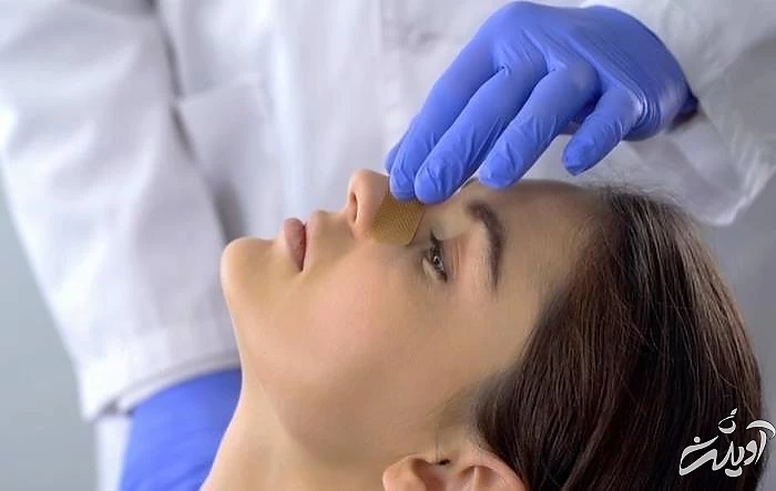 عمل بینی طبیعی